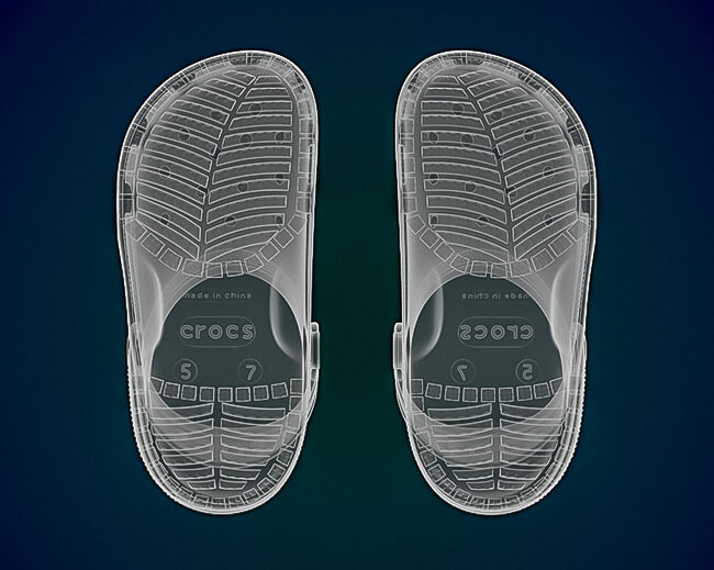 Crocs X-Ray